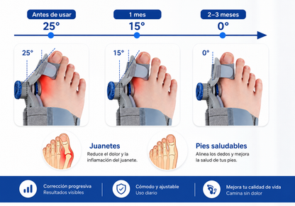 Corrector de Juanetes Premium