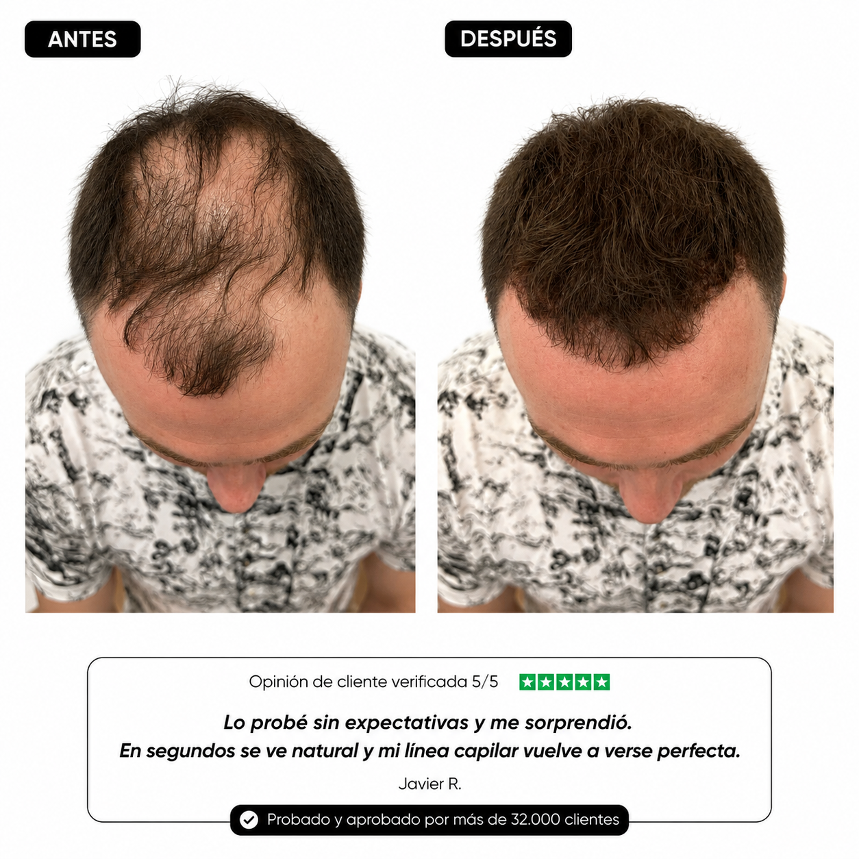 Corrector capilar para entradas y zonas débiles