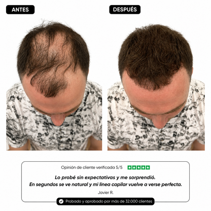 Corrector capilar para entradas y zonas débiles
